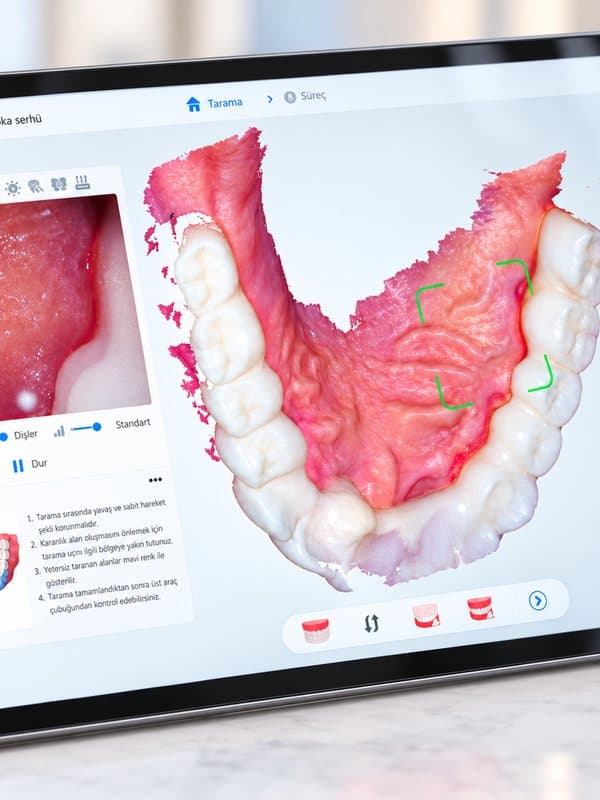 Digital Smile Design